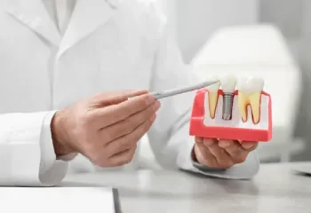 Dental implant Stafford
