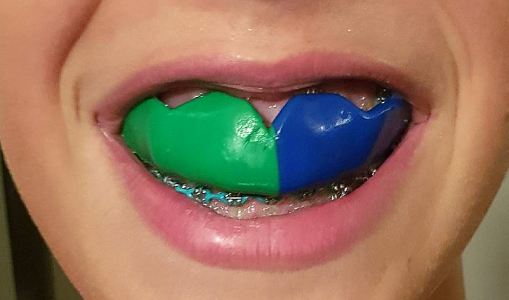 green_Blue_Mouthguard